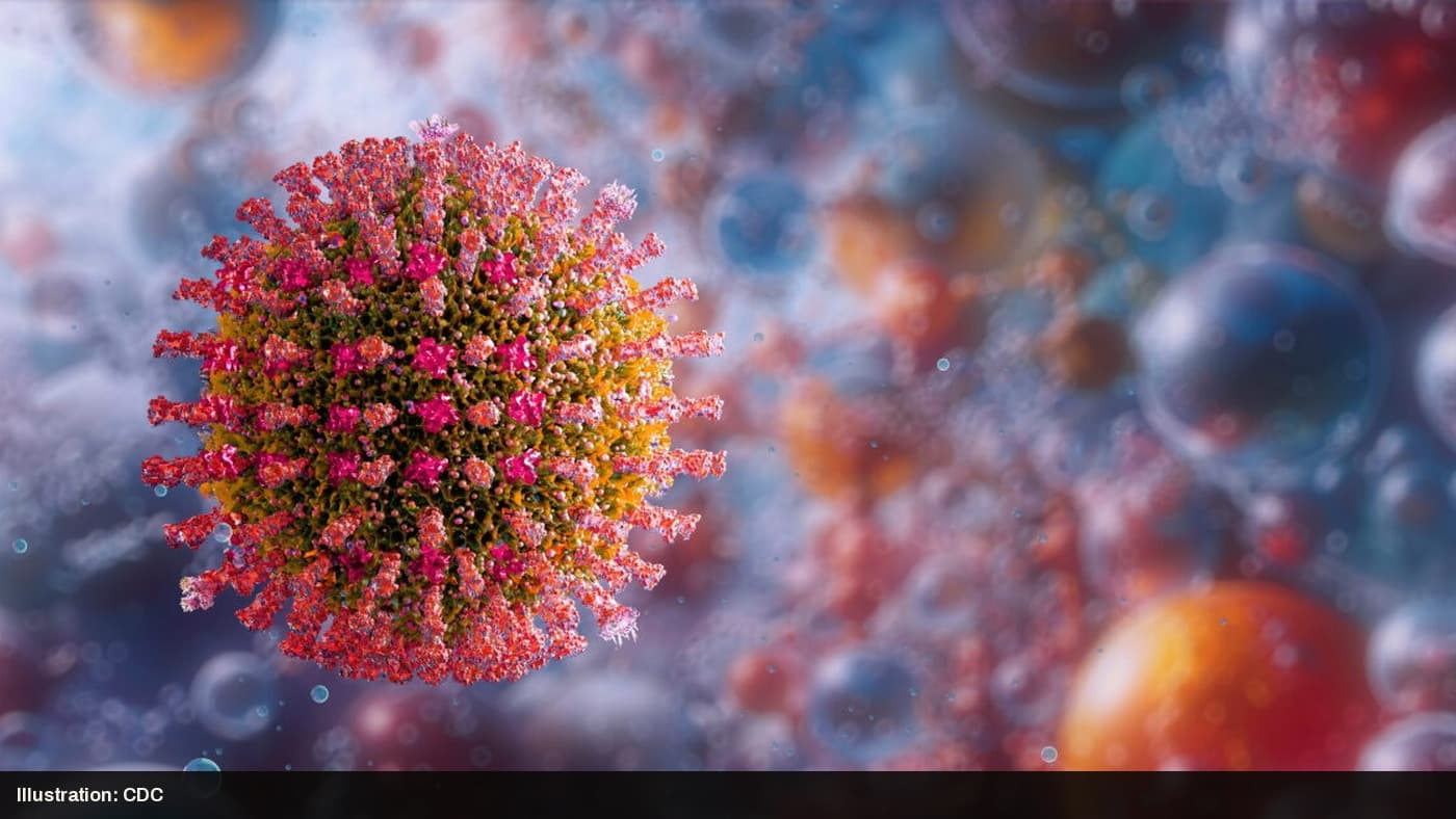 A 3D medical illustration of a measles virus particle.
