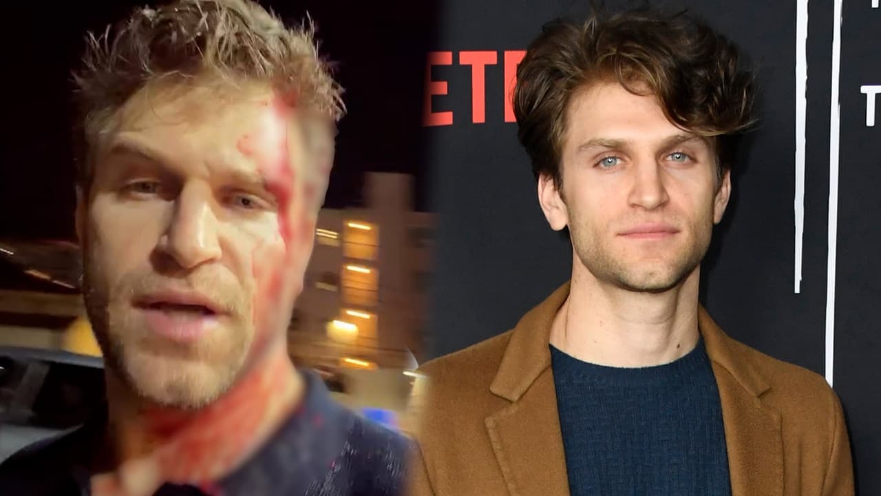 Actor Keegan Allen reported being attacked and robbed outside a grocery store in West Hollywood.